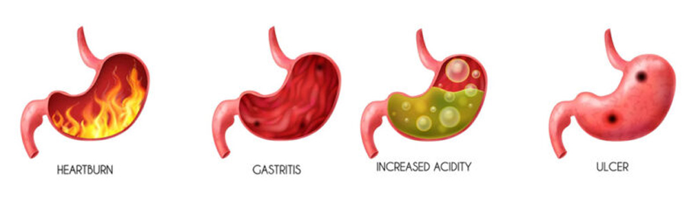 Gastroenterology​